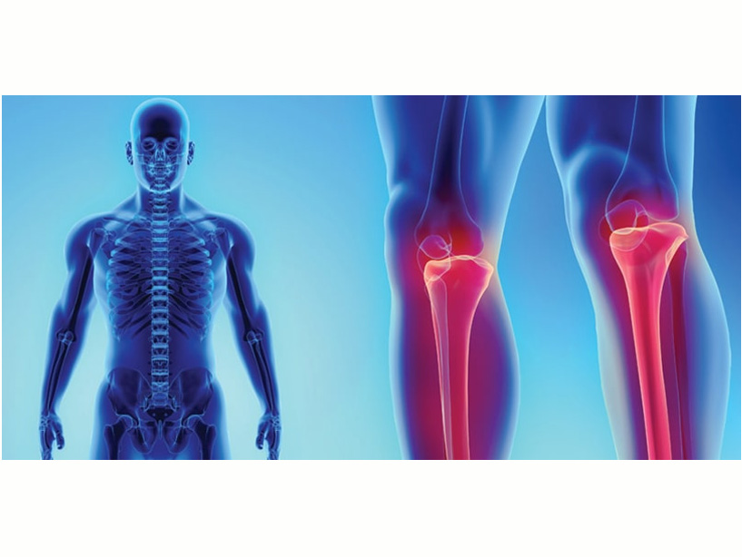 Deformity Correction Treatment by Dr. Ketan Vekhande is a renowned Orthopedic & Joint Replacement Surgeon & Specialist in Trauma, Sports Medicine and Arthroscopy in Aurangabad Maharashtra.