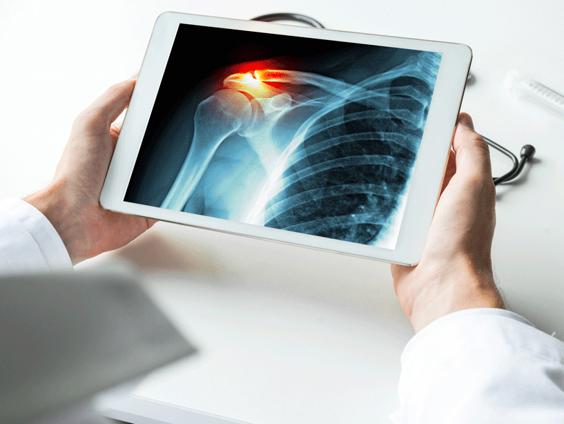 Digital X-Ray service at Swastik Orthopaedic Hospital, led by Dr. Ketan Vekhande. Experience, best Arthroscopic  & Joint Replacement Surgeon in Aurangabad.